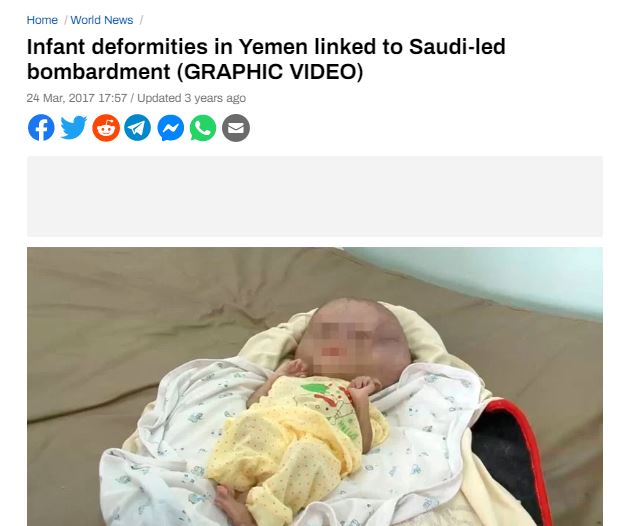 Yemen Babies Radiation Defects