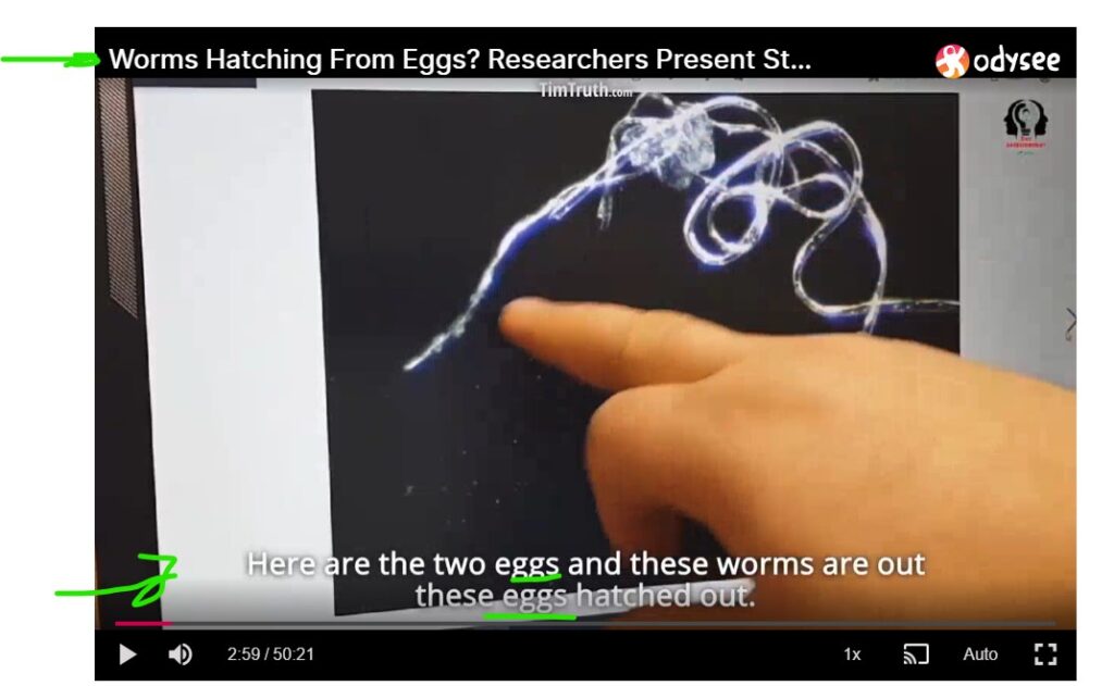 Vaccine Worms Hatching Inside Body