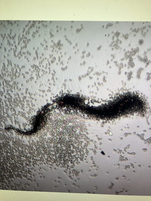 graphene parasite inside human body surrounded by graphene