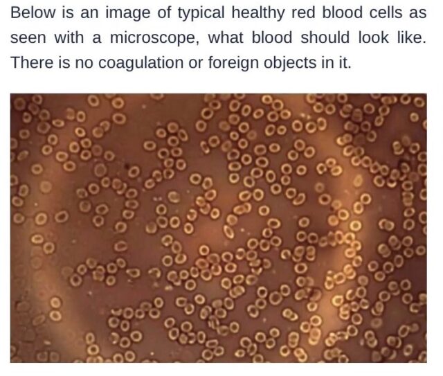 Red Blood Cells Non Vaccinated