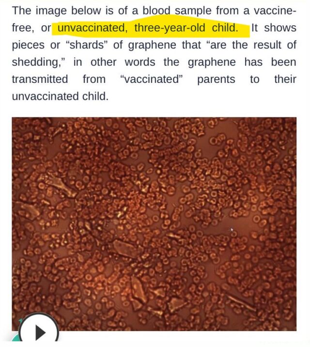 unvaccinate_child_shedded_on_By_Vaccinated