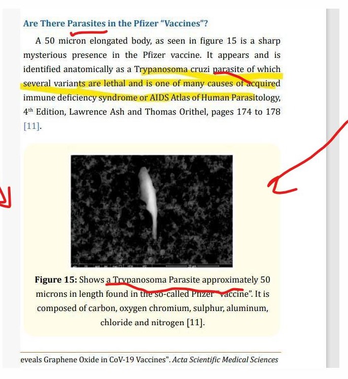 Dr. Robert Young Trypanosoma cruzi Parasite