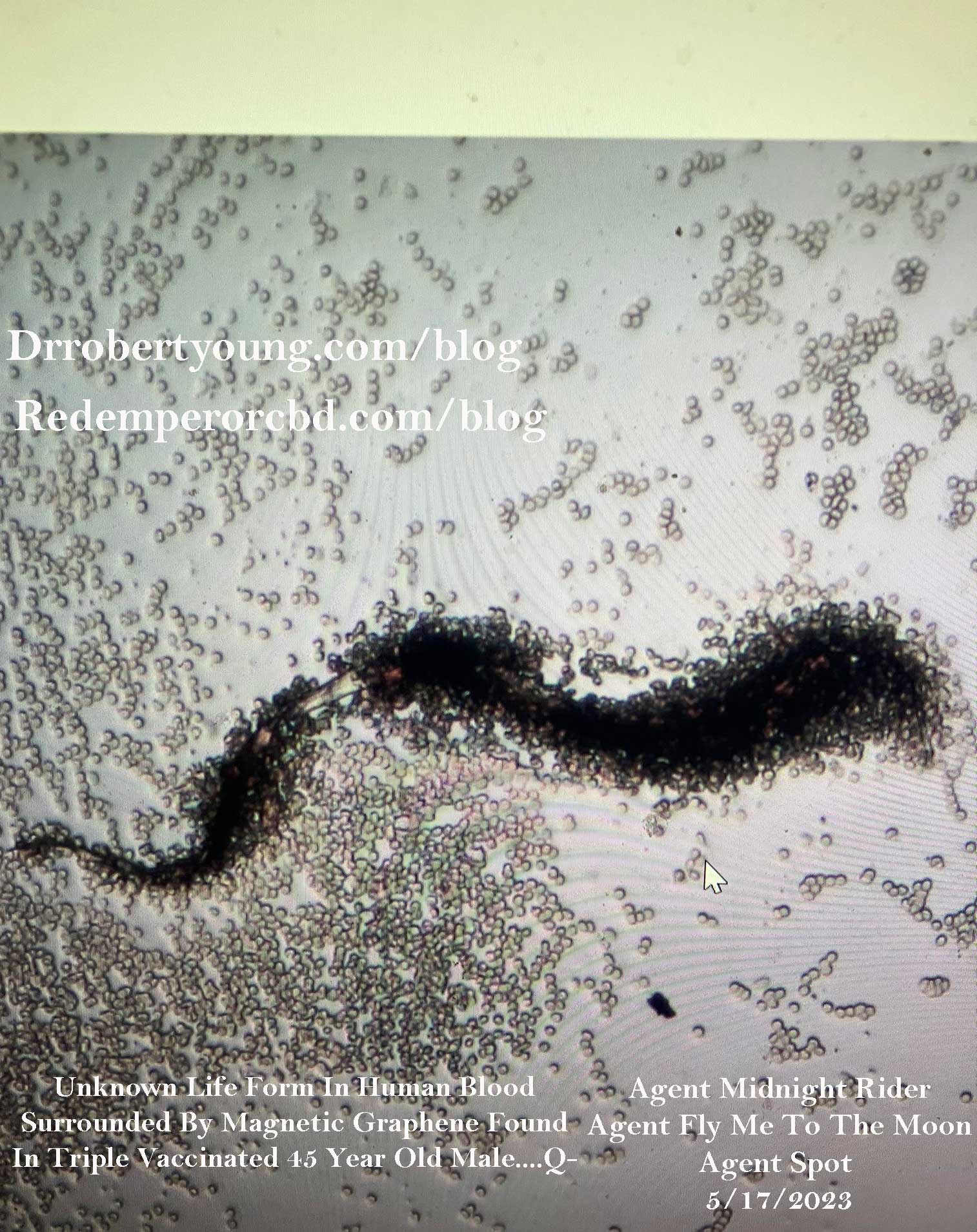 Trypanosoma Cruzi Parasite in vaccinated Male